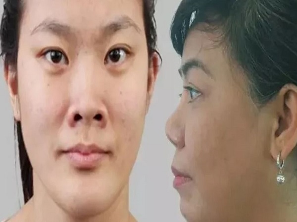 Tướng mặt phụ nữ xấu  là mũi hếch, lỗ mũi lộ rõ